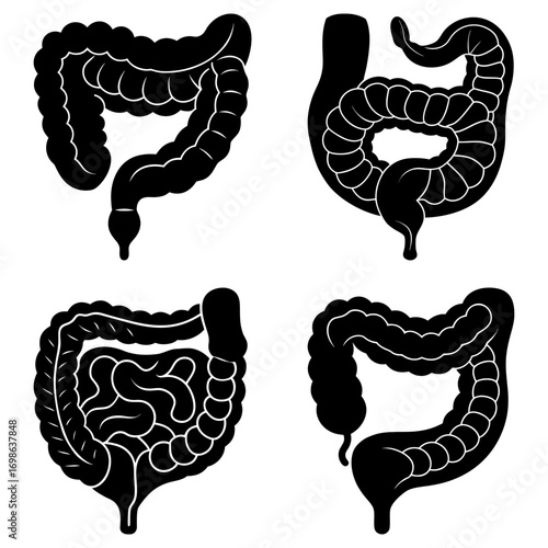 Four black and white anatomical illustrations of the human colon and large intestine structures shown