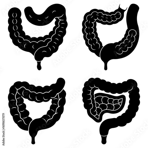 Four anatomical illustrations of the human colon in black and white on a plain white background view