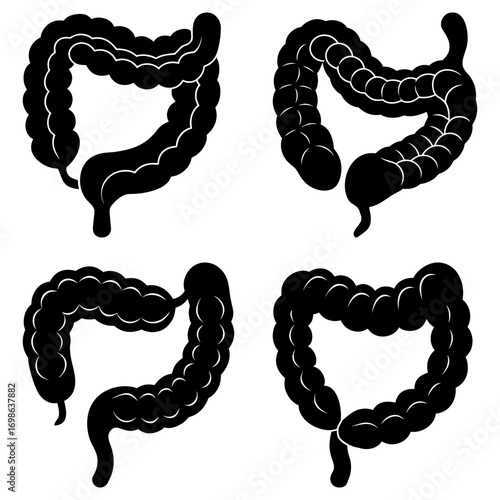 Four black and white illustrations of human colon anatomy in different orientations on a white background