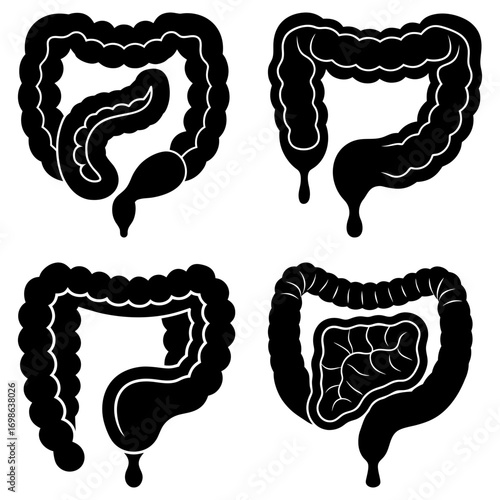 Four black and white illustrations of human colons with varying shapes and internal structures shown clearly