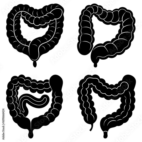 Four black and white illustrations of the human colon with varying shapes and configurations presented