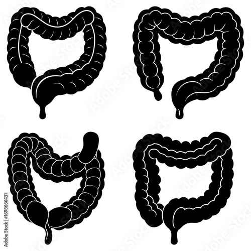 Four black and white colon illustrations showing different shapes and orientations on a white background