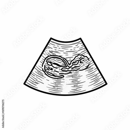 Early stage pregnancy ultrasound showing a developing fetus, a symbol of new life and anticipation.