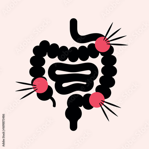 Illustration of human intestines with red spots representing inflammation or disease