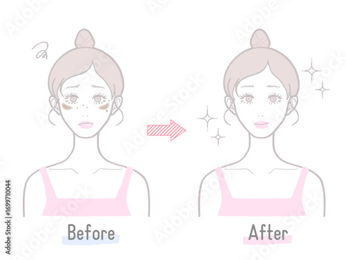シミや肝斑など肌のビフォーアフター比較で伝える女性スキンケア効果イラスト