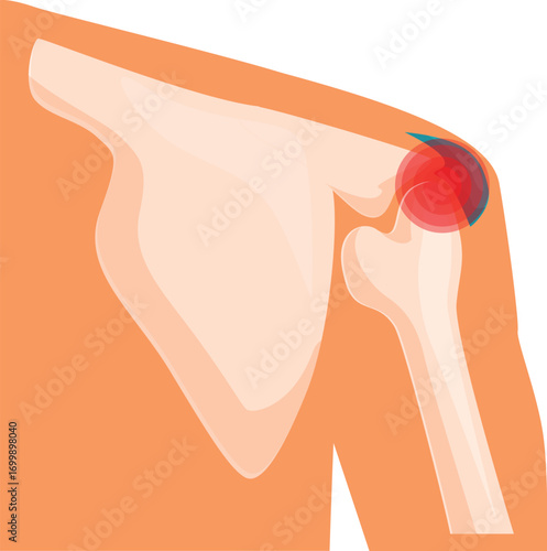 Human shoulder showing bones and joints highlighted in red indicating pain