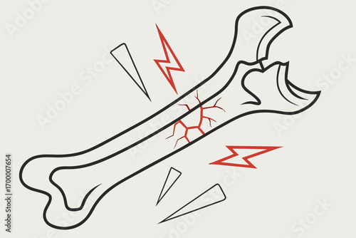 Fractured Bone with Red Lightning Bolt Symbol.