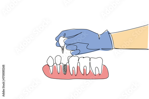 A single line drawing of full human teeth anatomy, emphasizing medical education and health concept for World Day for Assistive Technology in a minimalist flat illustration design style.