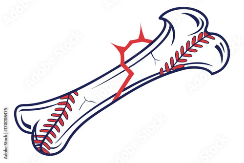 Cracked baseball bone illustration