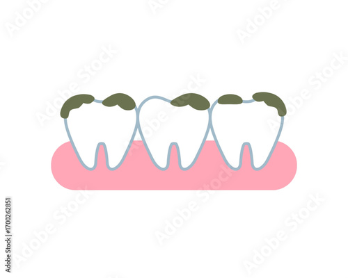 Illustration depicting neglected human teeth with significant plaque buildup along the gumline, highlighting poor oral hygiene and the potential for dental health issues