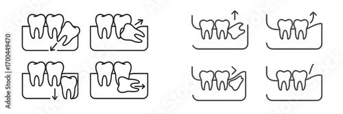 Wisdom tooth impaction and extraction line icon set showing different types of dental problems and oral surgery procedures for third molar removal