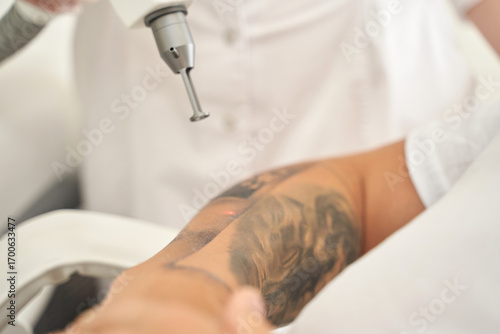 Asian female undergoing laser tattoo removal on arm by professional technician in clinic setting.
