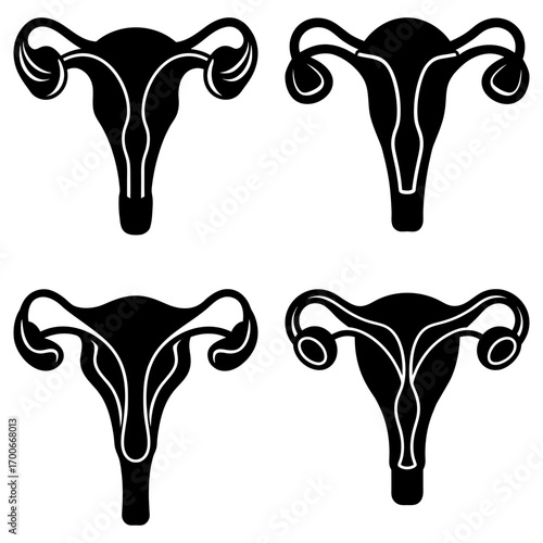 Four uterus illustrations in black and white showing anatomical variations and reproductive system details