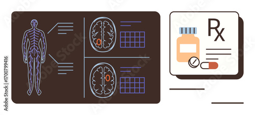 Human nervous system diagram, brain scans highlighting specific areas, prescription bottle, and pills. Ideal for healthcare, neurology, diagnostics, medical research, pharmaceuticals brain health