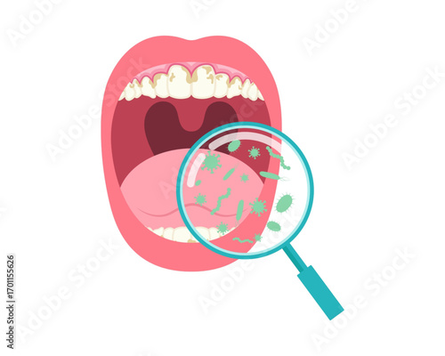 Conceptual illustration of poor oral hygiene with a magnifying glass revealing harmful bacteria, plaque, and tartar on unhealthy human teeth