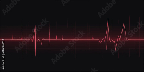 Vector medical illustration of heartbeat graph on a cardiogram