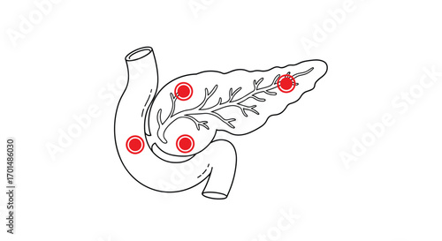Understanding pancreatic lesions detection and diagnosis methods for early cancer detection