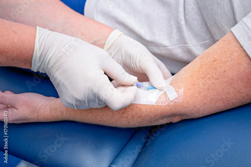 Nurse or doctor inserting IVC cannula into vein of patient, for IV fluids and medication, gp general practice australia, medical healthcare clinic