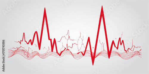 A continuous red and green pulse line on a medical electrocardiogram monitor shows a healthy heartbeat rate