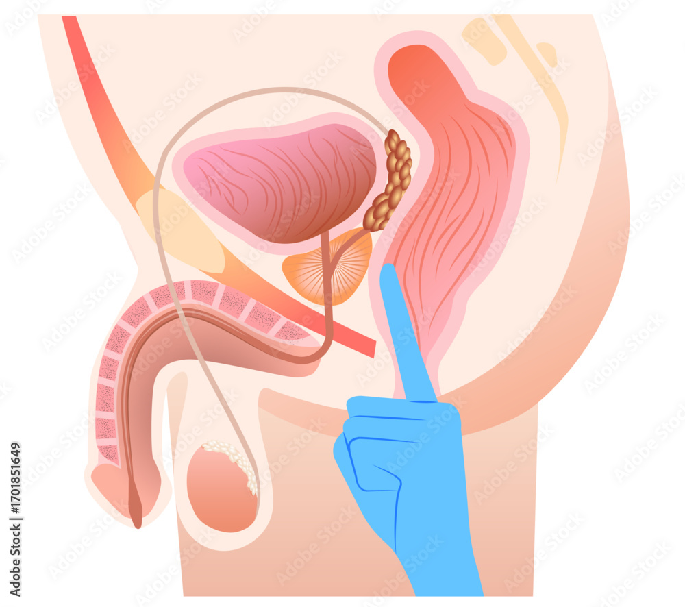 Fototapeta premium Prostate massage