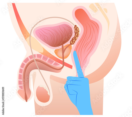 Prostate massage