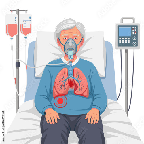 Elderly patient with oxygen mask and IV drip showing respiratory distress in hospital bed