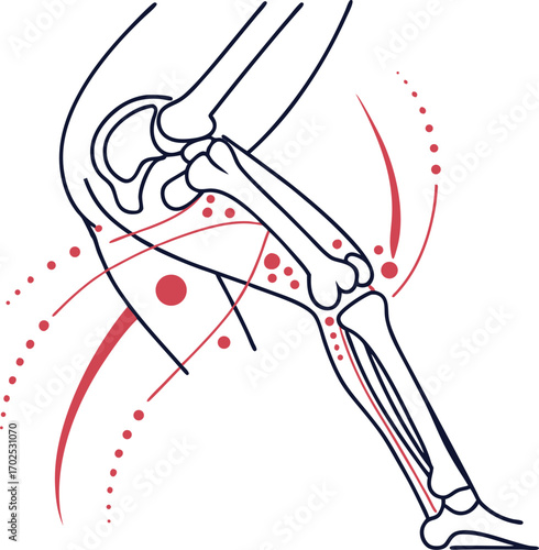 Lower Limb Skeleton with Pain Points, Knee and Ankle Joint Inflammation, Human Leg Anatomy and Painful Areas, Leg and Knee Injury Conceptual Diagram