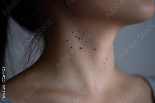 Wallpaper Mural Close-up of small moles on fair skin, adult female Torontodigital.ca