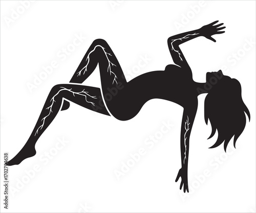 Black silhouette of woman body with varicose veins isolated on white background, vector illustration symbolizing health, medical problem, vascular disease, circulation, pain, therapy, anatomy, and vei