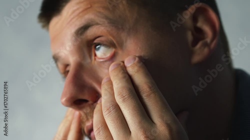 Wallpaper Mural Allergy sufferers rub their eyes due to inflammation and eye pain caused by allergies.
Inflammation of the eyeball and pain due to allergies.
Eye sensitivity and blindness.
Eye strain due to work. Torontodigital.ca