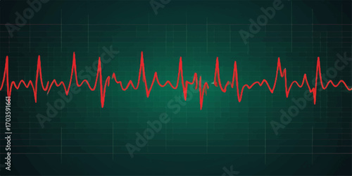Cardiogram of a healthy heartbeat on a medical monitor