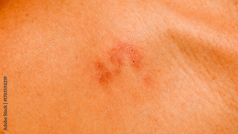 Fototapeta premium A reddish mark is visible on skin, resembling a pet's paw print. The imprint suggests playful interaction with an animal. Warm indoor lighting highlights the detail of the mark
