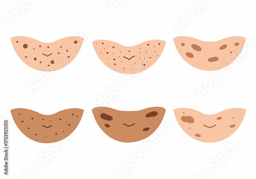 Cute cartoon illustrations of diverse skin tones with various features like freckles, moles, and spots, each smiling, promoting skin positivity and acceptance.