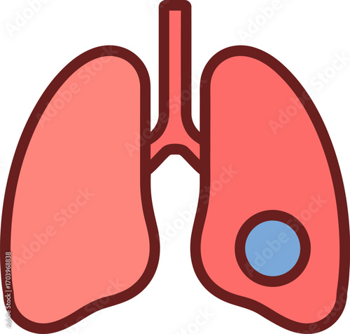 Stylized illustration of human lungs with a visible nodule representing a health concern or condition.
