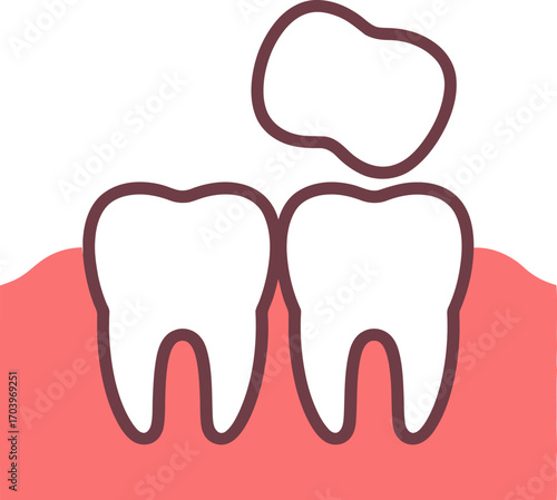 Illustration of a damaged tooth or tooth with cavity causing pain and discomfort.