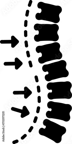Diagram illustrating spinal compression or pressure on the spine with arrows indicating force.