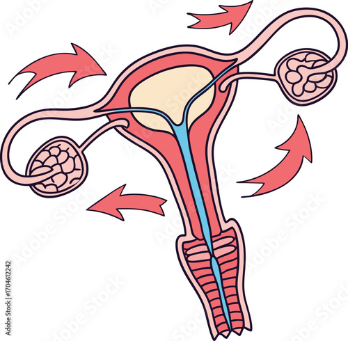 Uterus with IUD and Arrows Showing Contraception Diagram of an IUD Placement in the Uterus Scientific Illustration of an Intrauterine Device Female Contraception Concept with IUD and Fallopian Tubes