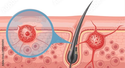 Detailed skin anatomy illustration showcasing a hair follicle and zoomed view of a sebaceous gland