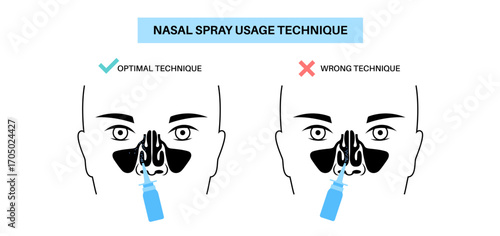 Proper nasal spray usage
