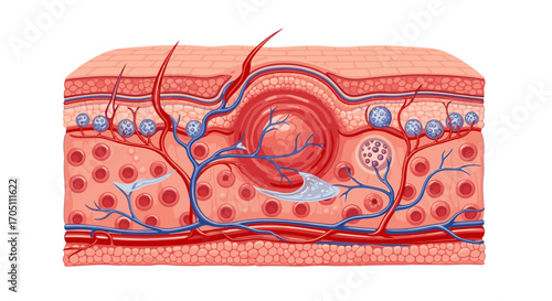 Detailed skin anatomy illustration with inflammation for medical educational purposes and dermatology materials