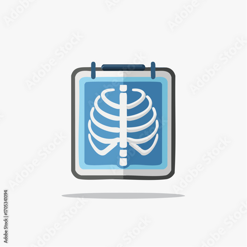 XRay Image of a Human Rib Cage.