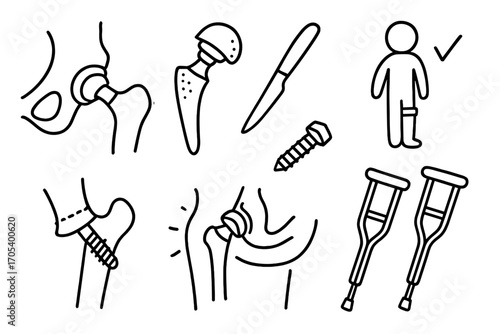 Hip Replacement Doodle. Hand-drawn doodle illustration hip replacement artificial joint, metal implant, hip prosthesis, surgery
