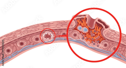 Detailed illustration of a cell structure with inflammation and immune response in focus