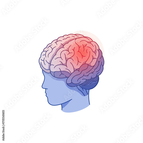 headache illustration showing brain pain a stressful medical condition impacting cognitive function and causing stress for healthcare  neurology articles