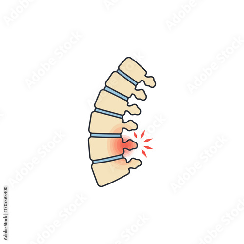 spinal pain illustration spine injury anatomy with red pain signals indicating lumbar disc herniation for medical or healthcare content