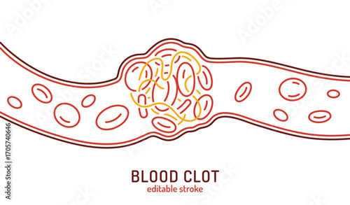 Blood Clot Background Vector illustration useful for presentations