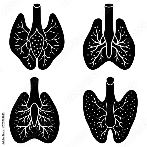 Four lung illustrations with varying internal structures in black and white drawing style on a white background