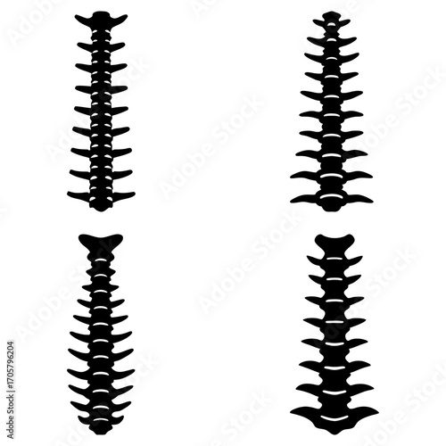 Anatomical illustration showing four different spinal column variations in black silhouette on white background