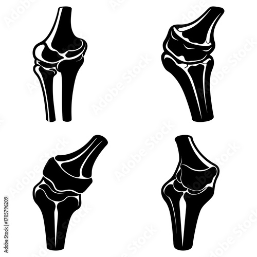 Illustration of four knee joint diagrams in black and white showing anatomical structure of the knee area