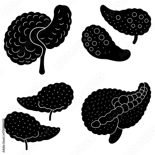 Four pancreas illustrations in black and white showing different anatomical perspectives and structures